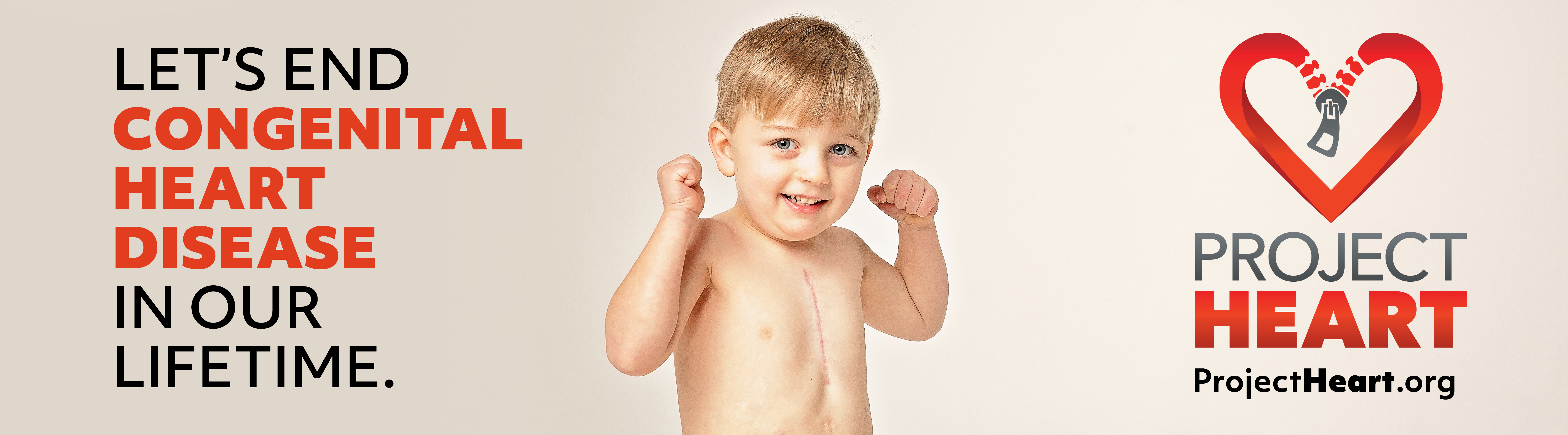 Project Heart billboard — Let's end congenital heart disease